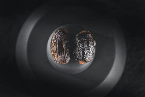 Varicocele: A Guide for Men | Kindly Health