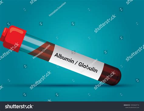 Blood Sample Ag Ratio Albumin Globulin Stock Vector (Royalty Free ...