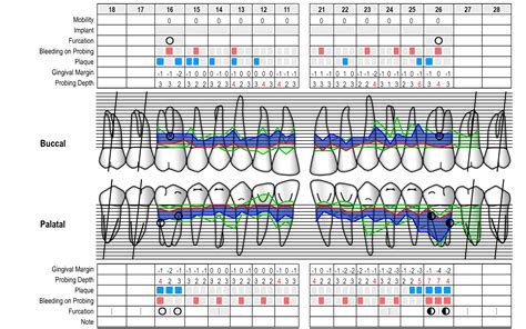 Periodontal Chart online - www.perio-tools.com