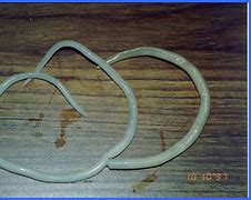 Image result for 蛲虫 Pinworms