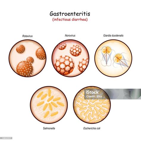 Infectious Diarrhea Cartoon Diarrhea Cartoons And Comics Funny