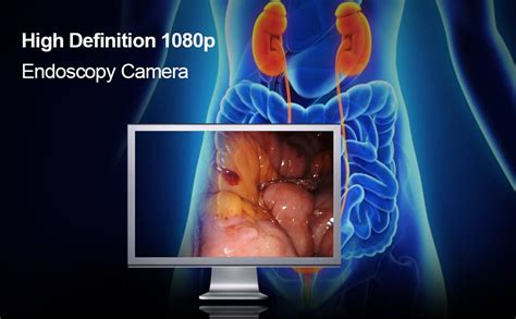 ESC Medicams Wired Endoscopy Camera Laparoscopic Unit Full Hd w/USB ...