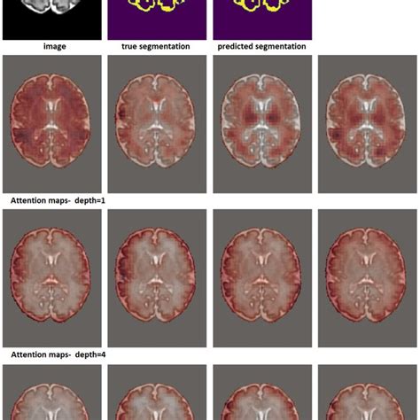Image result for Image Segmentation Graph Convolution Network