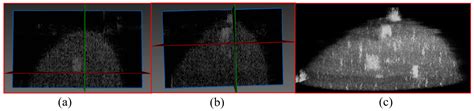 Development of a 1 × 512 Ring Transducer Array-Based 3D Ultrasound ...