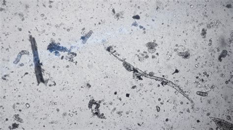 Addressing an Overlooked Risk: How Contaminated Ultrasound Probes Transmit STDs, and an ...