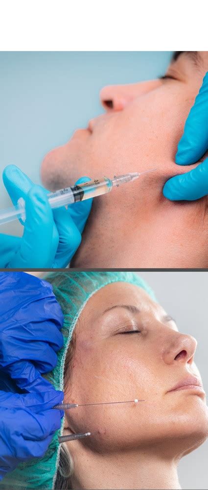 Scar Treatment with Fillers & Threads - inurskn