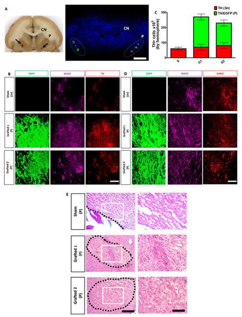 Human Embryonic Stem Cell-Derived Immature Midbrain Dopaminergic ...