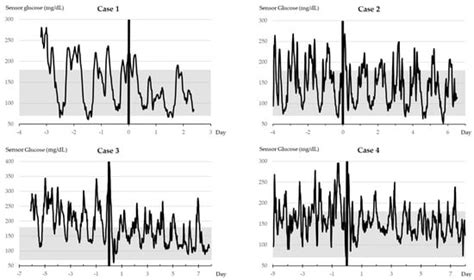Tirzepatide and Glycemic Control Metrics Using Continuous Glucose ...