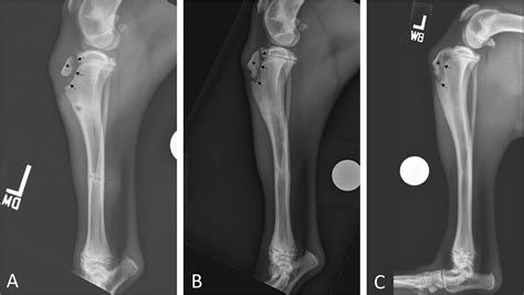 Use of a hybrid external skeletal fixator construct for managing tibial tuberosity avulsion ...