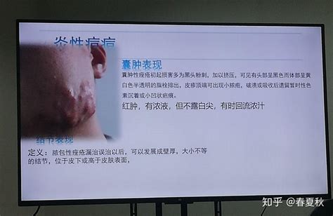 广州慕可生物科技有限公司新媒体营销策略分析