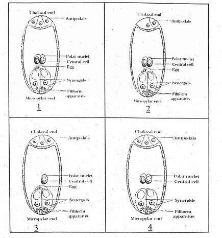 Select the correct diagram