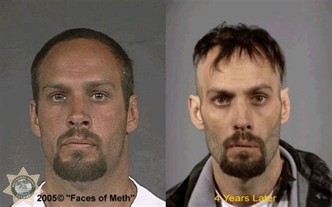 Faces Of Meth Video : Faces of meth - MRCQ