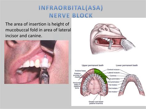 PPT - I NNERVATION & VASCULARIZATION OF THE ORAL REGION PowerPoint ...