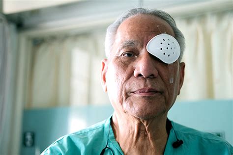 Best Artificial Cosmetic Eye (Ocular Prosthesis) Surgery