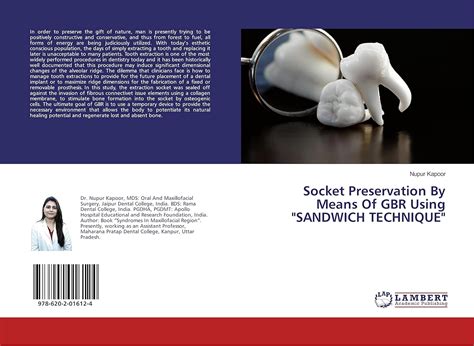 Buy Socket Preservation By Means Of GBR Using "SANDWICH TECHNIQUE" Book ...
