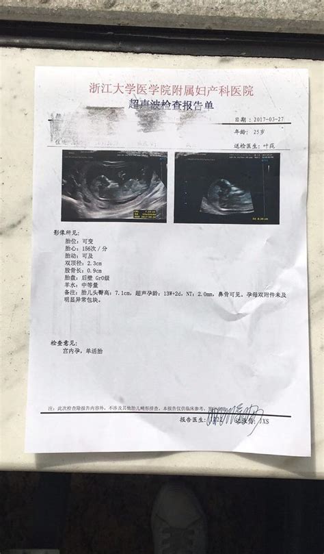 孕期必做的超声B超检查—顺产男宝宝，附B超检查报告单