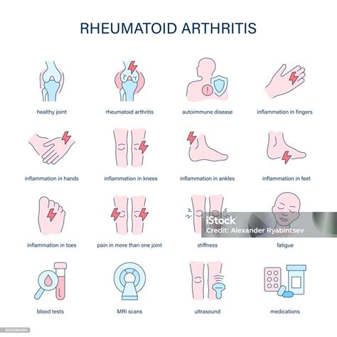 Rheumatoid Arthritis Symptoms Diagnostic And Treatment Vector Icons Medical Icons Stock ...
