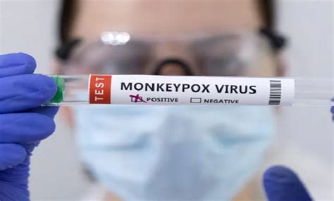 Delhi's First Monkeypox Patient Is Discharged From Hospital; Recovered ...