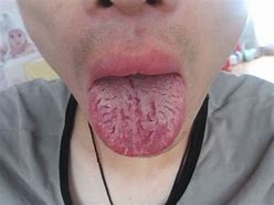 舌头 的图像结果