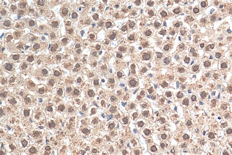 GCH1 antibody (28501-1-AP) | Proteintech
