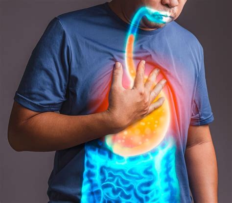 Heartburn Symptom In Singapore | Causes, Treatments & More | GUTCARE