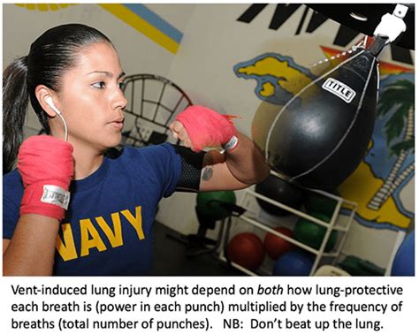 Image result for APRV Mode Setup