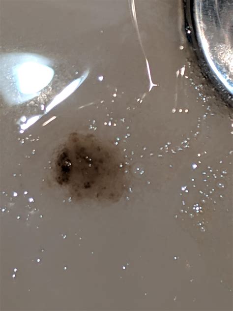 I've been sober for two weeks now and I'm coughing up some nasty stuff. Is this normal? Does ...