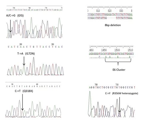 Electropherogram Interpretation 的图像结果