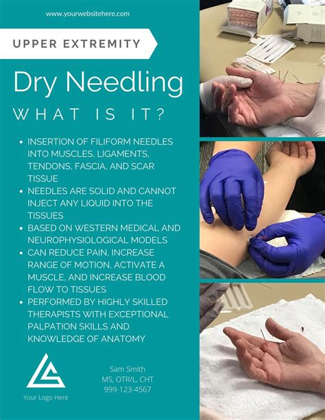Dry needling—what is it and how are therapists using it in their ...