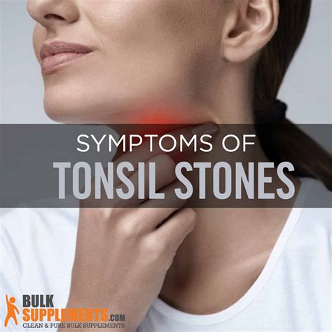 Can Tonsil Stones Cause Mouth Sores - Infoupdate.org