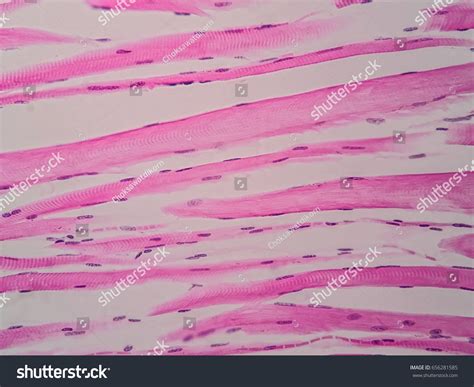 Microscope Slide Of Skeletal Muscle at Philip Pacheco blog