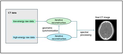 Visibility of Intracranial Perforating Arteries Using Ultra-High ...