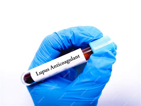 Premium Photo | Lupus anticoagulant test
