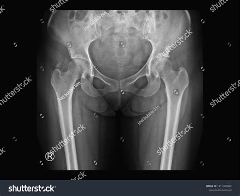 2 R In A Shock Wave Images, Stock Photos & Vectors | Shutterstock