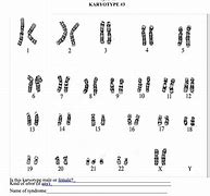 Image result for karyotypes