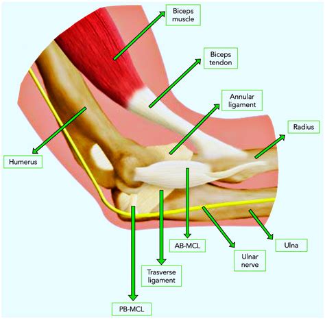 Ulnar Neuropathy Dynamic Ulnar Nerve Compression At The Elbow In A