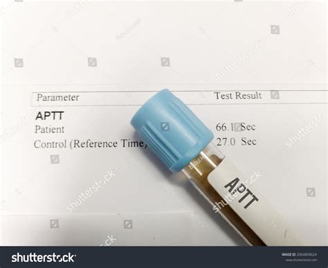 816 Blood Coagulation Patient Images, Stock Photos & Vectors | Shutterstock