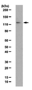 Anti-JMJD1A Antibody from rabbit, purified by affinity chromatography ...
