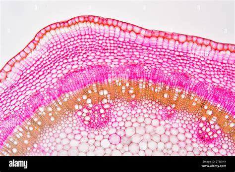 Eudicot young stem of Tilia sp. showing cuticle, epidermis, collenchyma ...
