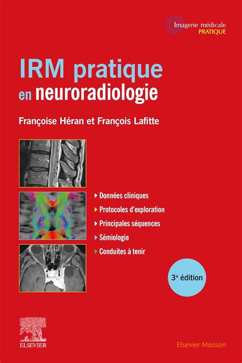 Buy IRM pratique en neuroradiologie Book Online at Low Prices in India ...