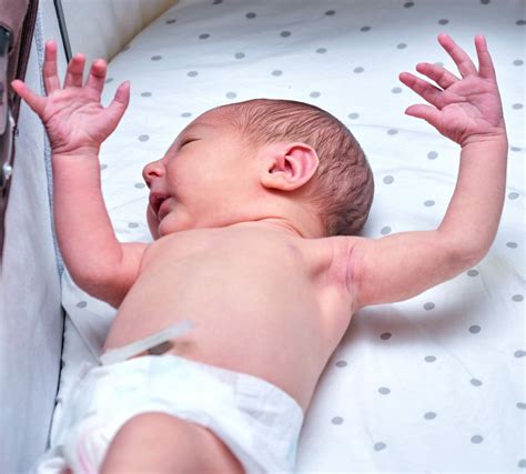 Moro Reflex Testing 的图像结果