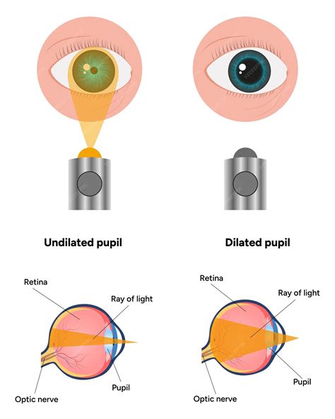 Premium Vector | Pupil size in different lighting Dilated pupil and Undilated pupil with Eye ...