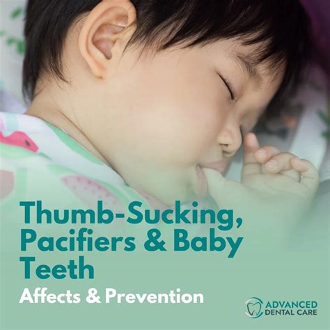 Thumb-Sucking, Pacifiers & Baby Teeth: Affects & Prevention