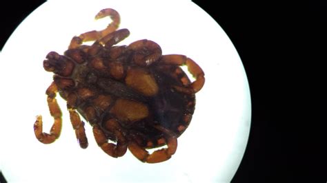 New tick-borne virus discovered in China can affect…