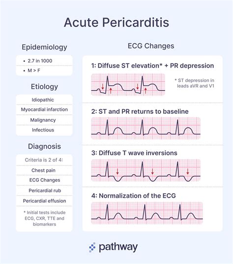 Constrictive Pericarditis Ecg