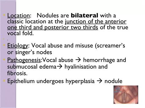 Symposium Vocal Nodules And Polyp | PPT