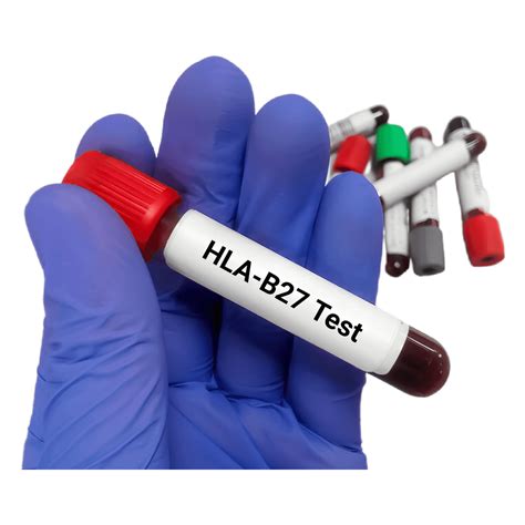 HLA-B27 FLOW CYTOMETRY – Thyrocare Aarogyam centre/Diagnostic Centre ...