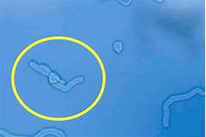 mosche volanti cure oculista torino e alberto bellone micro mosche volanti cure oculista torino e alberto bellone micro