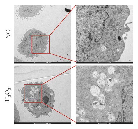 H2O2 Apoptosis 的图像结果