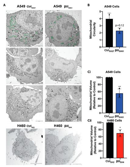 βIII-Tubulin Structural Domains Regulate Mitochondrial Network ...